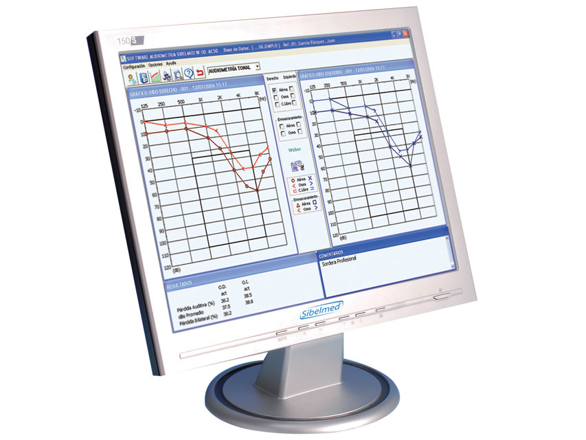 W50 programmatūra audiometrijai.