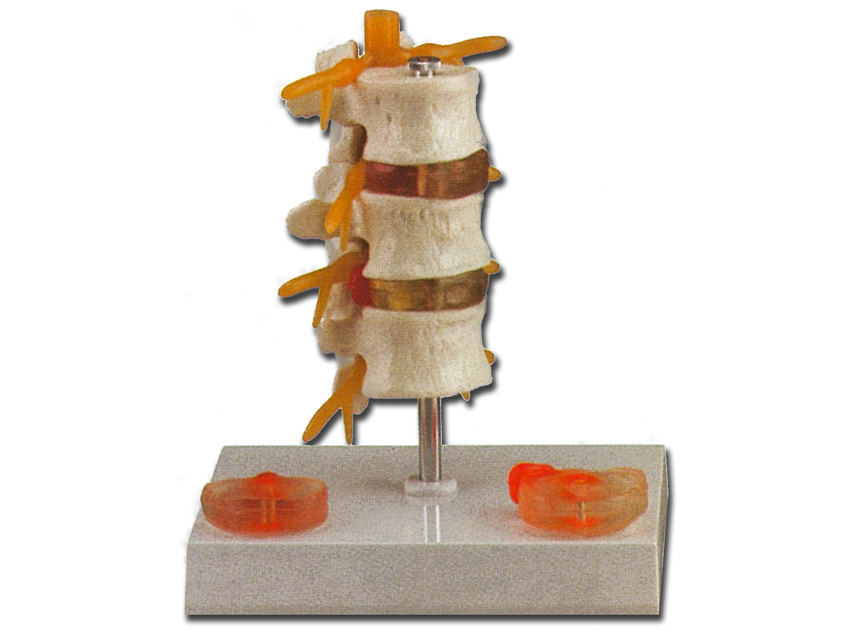 Trūces patoloģija (hernia pathology)